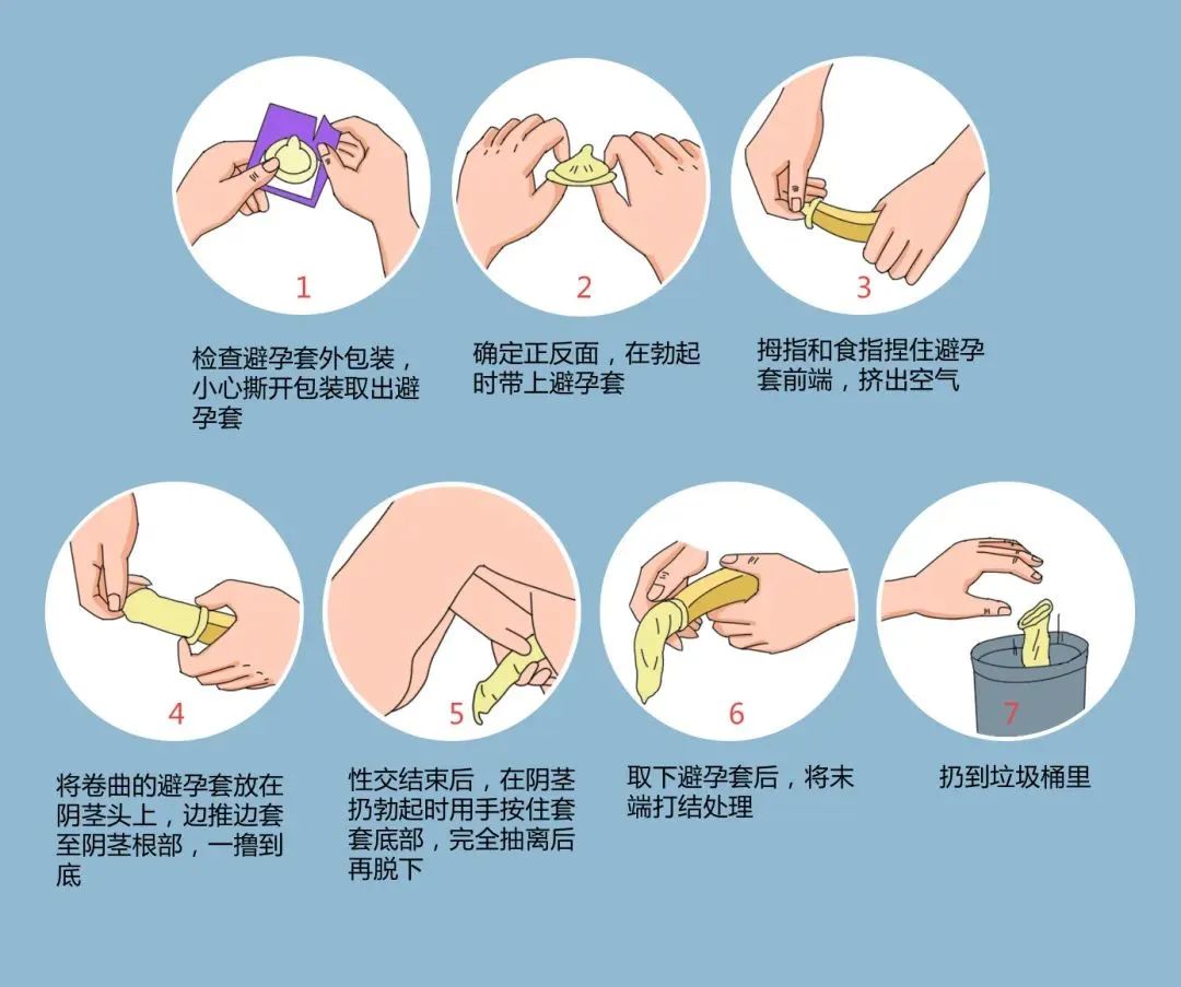 年輕人成艾滋病重災(zāi)區(qū)，正確戴套很有必要.jpg